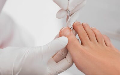 Pédicure médicale au Luxembourg : comment Luc Weber prend soin de vos pieds ?