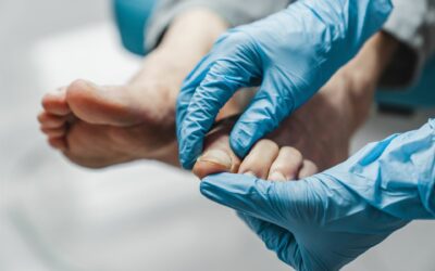 Soin de votre mycose à Esch-sur-Alzette : comment Luc Weber aide à rétablir la santé de vos pieds