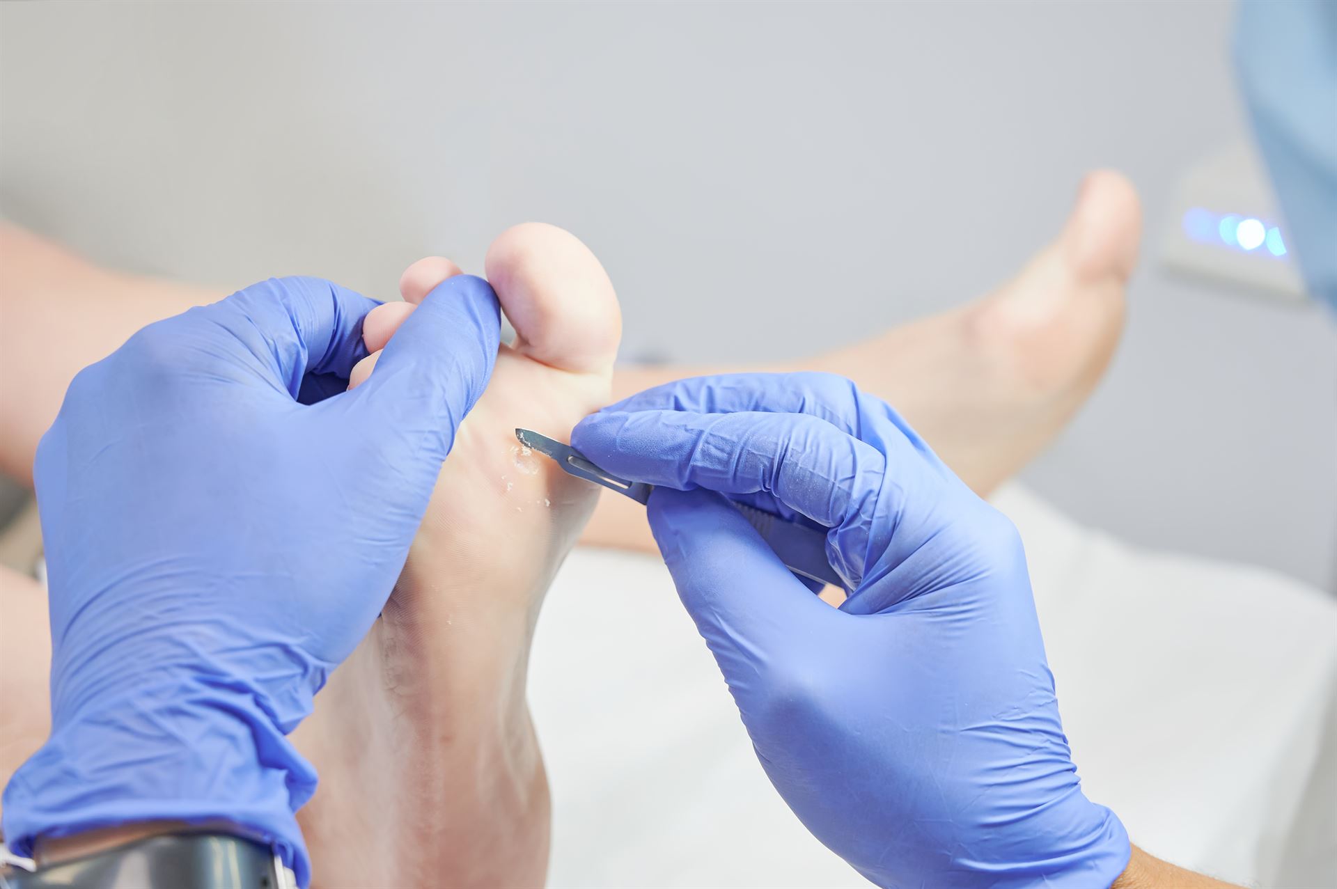 AdobeStock_605302715 Pédicure pour personnes diabétiques au Luxembourg